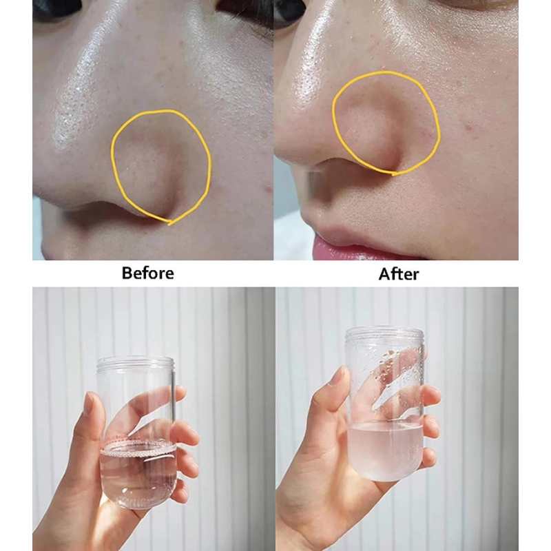 Machine mini Hydraface - Machine de livres de pelage de jet d'oxygène, soin du visage hydratant, microneedling,