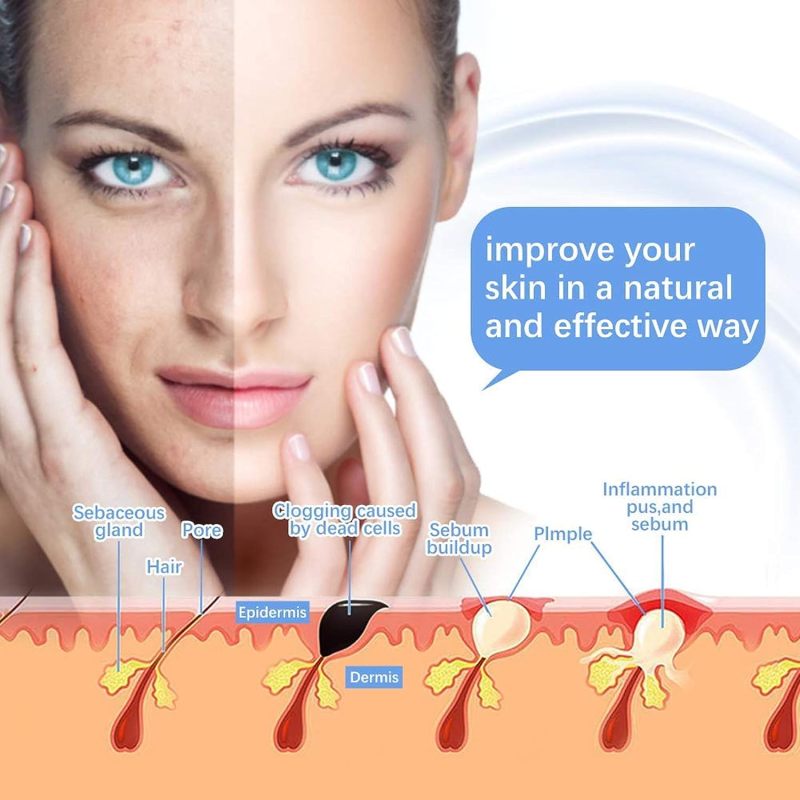 Machine Haute Fréquence Portable LZ-006A